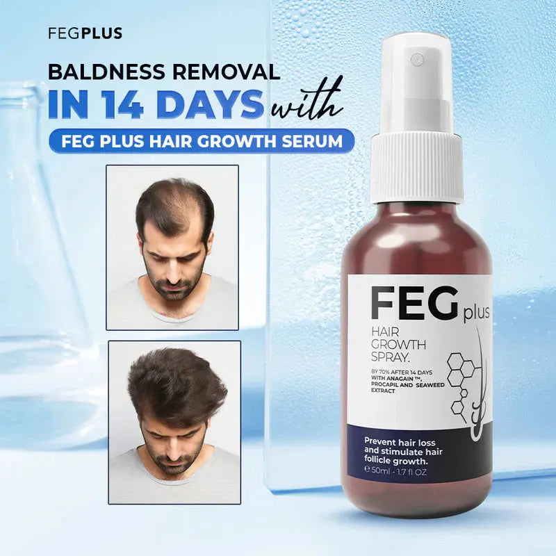 🌿 FEG Plus Hair Growth Spray 💧 | 🌟 Anti-Hair Loss Treatment for Men & Women 🧑‍🦱👩‍🦰 | ⚡ Boosts Regrowth & Thickens Hair 💪 | Minoxidil + Herbal Extracts 🌱 | 50ml Bottle