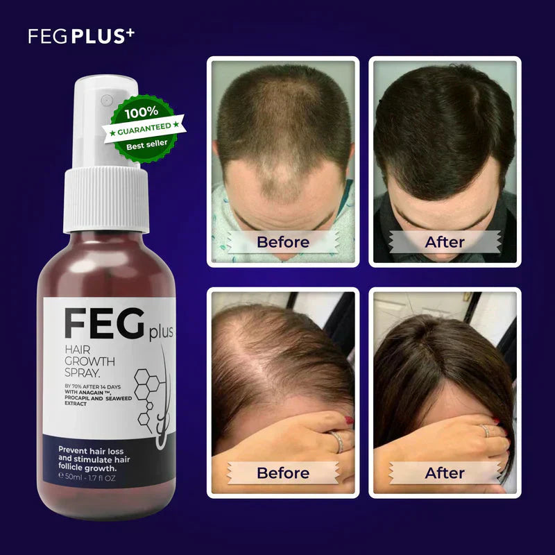 🌿 FEG Plus Hair Growth Spray 💧 | 🌟 Anti-Hair Loss Treatment for Men & Women 🧑‍🦱👩‍🦰 | ⚡ Boosts Regrowth & Thickens Hair 💪