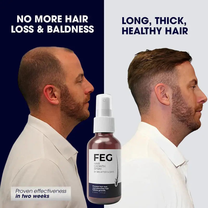 🌿 FEG Plus Hair Growth Spray 💧 | 🌟 Anti-Hair Loss Treatment for Men & Women 🧑‍🦱👩‍🦰 | ⚡ Boosts Regrowth & Thickens Hair 💪 | Minoxidil + Herbal Extracts 🌱 | 50ml Bottle
